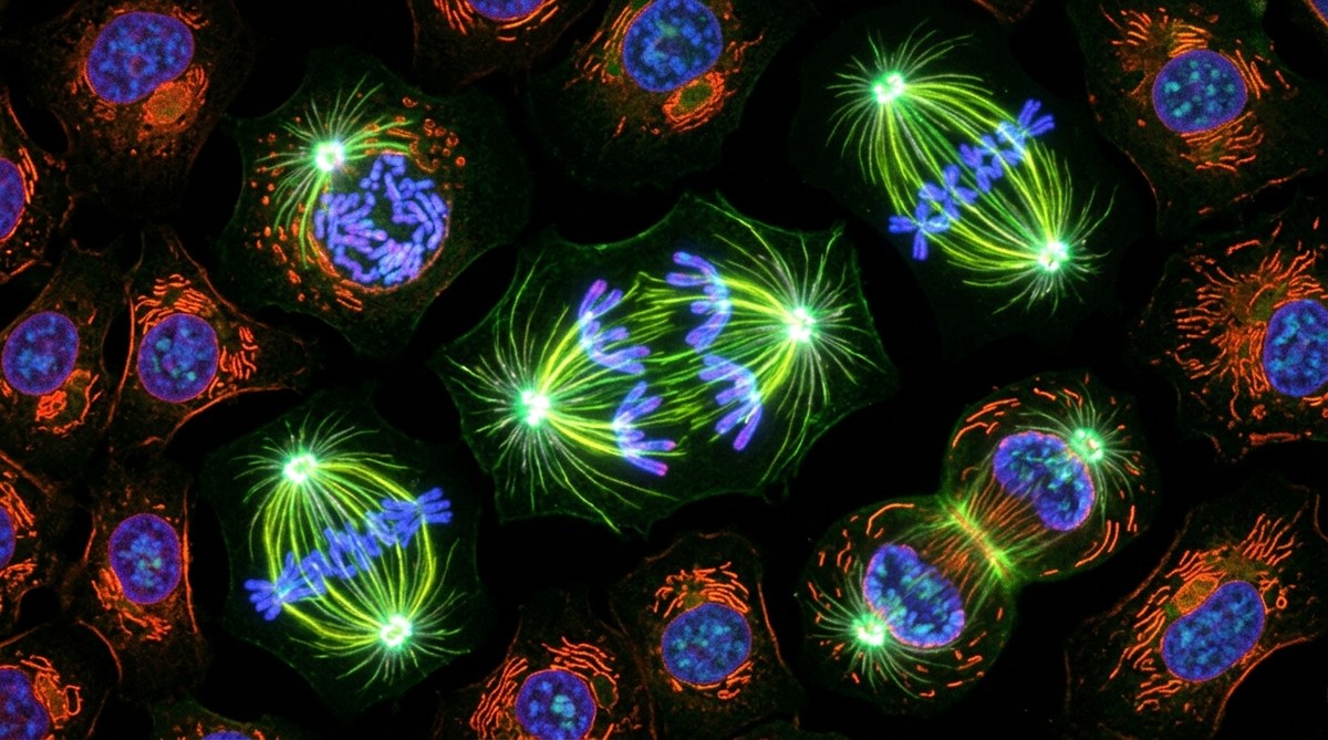 What Happens During Mitosis? A Complete Guide to Cell Division